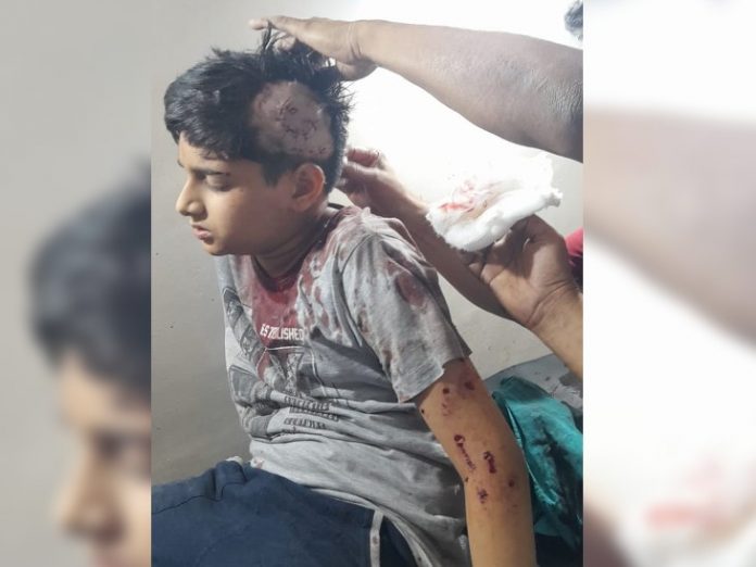 Deadly attack by dogs on a 12-year-old child in Kota