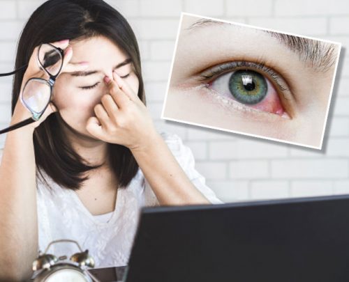 Get Rid Of Eye Problems : आंखों में दर्द से राहत दिलाए ये आसान टिप्स