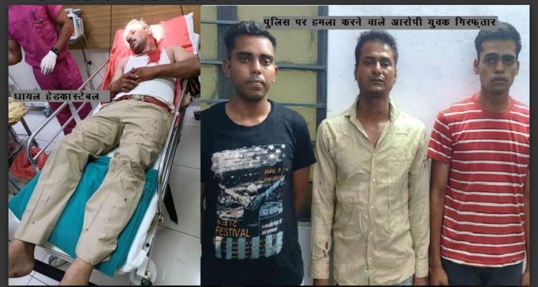 उदयपुर में शराब पीते युवकों को टोकना पड़ा पुलिस को भारी, पत्थरों से बोल दिया हमला, दो पुलिसकर्मी घायल