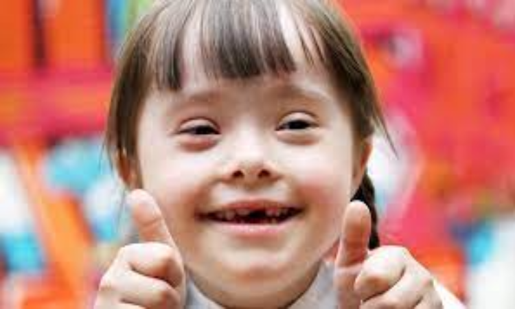 Down Syndrome: क्या है डाउन सिंड्रोम? जानें क्या है इसकी वजह और लक्षण