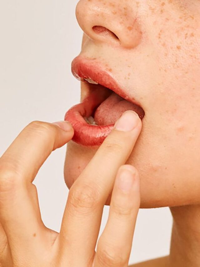 हल्के में न लें बार बार मुंह का सूखना, हो सकती हैं खतरनाक बीमारी